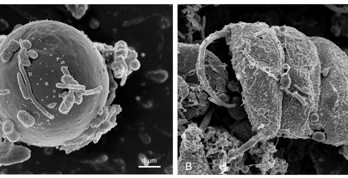 Chlorella (A) und Scenedesmus (B)